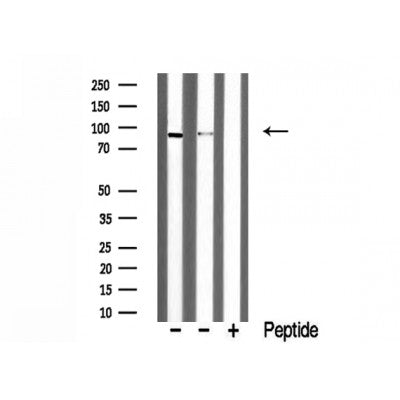 DF3270 staining HepG2 cells by IF/ICC. The sample were fixed with PFA and permeabilized in 0.1% Triton X-100,then blocked in 10% serum for 45 minutes at 25¡ãC. The primary antibody was diluted at 1/200 and incubated with the sample for 1 hour at 37¡ãC. An  Alexa Fluor 594 conjugated goat anti-rabbit IgG (H+L) antibody(Cat.# S0006), diluted at 1/600, was used as secondary antibod