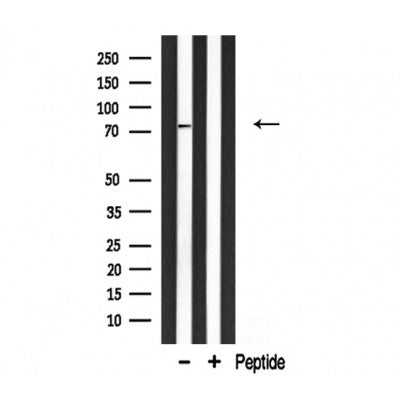 DF3274 staining HepG2 cells by IF/ICC. The sample were fixed with PFA and permeabilized in 0.1% Triton X-100,then blocked in 10% serum for 45 minutes at 25¡ãC. The primary antibody was diluted at 1/200 and incubated with the sample for 1 hour at 37¡ãC. An  Alexa Fluor 594 conjugated goat anti-rabbit IgG (H+L) antibody(Cat.# S0006), diluted at 1/600, was used as secondary antibod