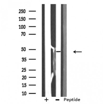 DF3275 staining HepG2 cells by IF/ICC. The sample were fixed with PFA and permeabilized in 0.1% Triton X-100,then blocked in 10% serum for 45 minutes at 25¡ãC. The primary antibody was diluted at 1/200 and incubated with the sample for 1 hour at 37¡ãC. An  Alexa Fluor 594 conjugated goat anti-rabbit IgG (H+L) antibody(Cat.# S0006), diluted at 1/600, was used as secondary antibod