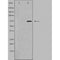 DF3278 staining K562 by IF/ICC. The sample were fixed with PFA and permeabilized in 0.1% Triton X-100,then blocked in 10% serum for 45 minutes at 25¡ãC. The primary antibody was diluted at 1/200 and incubated with the sample for 1 hour at 37¡ãC. An  Alexa Fluor 594 conjugated goat anti-rabbit IgG (H+L) Ab, diluted at 1/600, was used as the secondary antibod