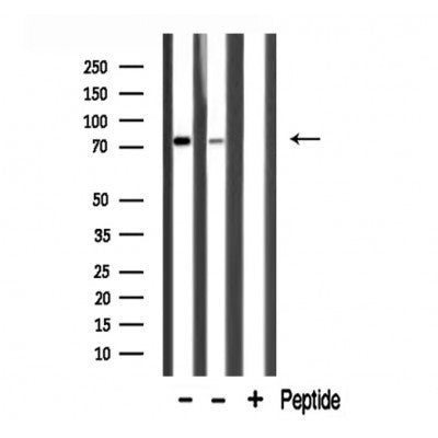 DF3279 staining COLO205 cells by IF/ICC. The sample were fixed with PFA and permeabilized in 0.1% Triton X-100,then blocked in 10% serum for 45 minutes at 25¡ãC. The primary antibody was diluted at 1/200 and incubated with the sample for 1 hour at 37¡ãC. An  Alexa Fluor 594 conjugated goat anti-rabbit IgG (H+L) antibody(Cat.# S0006), diluted at 1/600, was used as secondary antibod