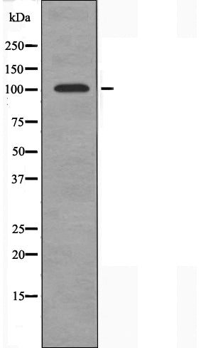 DF3283 staining  COLO205 cells by IF/ICC. The sample were fixed with PFA and permeabilized in 0.1% Triton X-100,then blocked in 10% serum for 45 minutes at 25¡ãC. The primary antibody was diluted at 1/200 and incubated with the sample for 1 hour at 37¡ãC. An  Alexa Fluor 594 conjugated goat anti-rabbit IgG (H+L) antibody(Cat.# S0006), diluted at 1/600, was used as secondary antibod