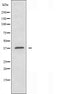 DF3284 staining Hela by IF/ICC. The sample were fixed with PFA and permeabilized in 0.1% Triton X-100,then blocked in 10% serum for 45 minutes at 25¡ãC. The primary antibody was diluted at 1/200 and incubated with the sample for 1 hour at 37¡ãC. An  Alexa Fluor 594 conjugated goat anti-rabbit IgG (H+L) Ab, diluted at 1/600, was used as the secondary antibod
