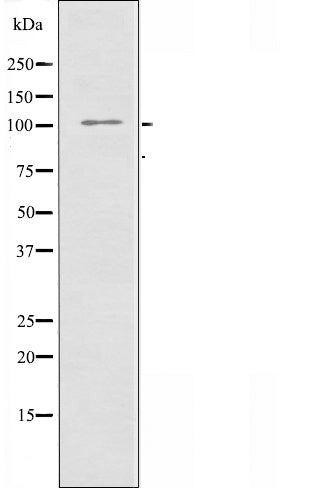 Western blot analysis of extracts from Jurkat cells using EPHA7 antibody.