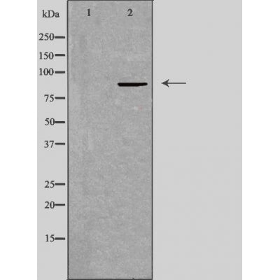 DF3290 at 1/100 staining Human breast cancer tissue by IHC-P. The sample was formaldehyde fixed and a heat mediated antigen retrieval step in citrate buffer was performed. The sample was then blocked and incubated with the antibody for 1.5 hours at 22¡ãC. An HRP conjugated goat anti-rabbit antibody was used as the secondary