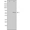 DF3291 staining  HeLa cells by IF/ICC. The sample were fixed with PFA and permeabilized in 0.1% Triton X-100,then blocked in 10% serum for 45 minutes at 25¡ãC. The primary antibody was diluted at 1/200 and incubated with the sample for 1 hour at 37¡ãC. An  Alexa Fluor 594 conjugated goat anti-rabbit IgG (H+L) antibody(Cat.