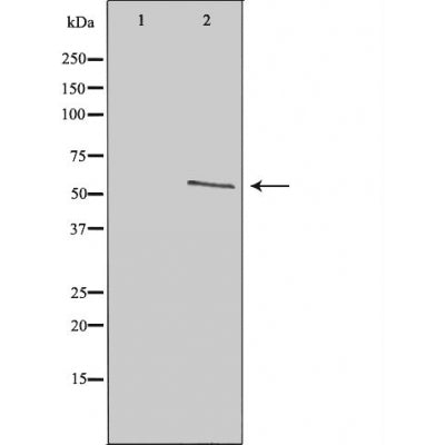 DF3291 staining  HeLa cells by IF/ICC. The sample were fixed with PFA and permeabilized in 0.1% Triton X-100,then blocked in 10% serum for 45 minutes at 25¡ãC. The primary antibody was diluted at 1/200 and incubated with the sample for 1 hour at 37¡ãC. An  Alexa Fluor 594 conjugated goat anti-rabbit IgG (H+L) antibody(Cat.