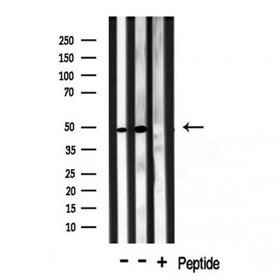 DF3293 staining LOVO cells by IF/ICC. The sample were fixed with PFA and permeabilized in 0.1% Triton X-100,then blocked in 10% serum for 45 minutes at 25¡ãC. The primary antibody was diluted at 1/200 and incubated with the sample for 1 hour at 37¡ãC. An  Alexa Fluor 594 conjugated goat anti-rabbit IgG (H+L) antibody(Cat.# S0006), diluted at 1/600, was used as secondary antibod