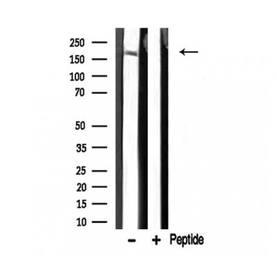 DF3294 at 1/100 staining Mouse colon tissue by IHC-P. The sample was formaldehyde fixed and a heat mediated antigen retrieval step in citrate buffer was performed. The sample was then blocked and incubated with the antibody for 1.5 hours at 22¡ãC. An HRP conjugated goat anti-rabbit antibody was used as the secondary