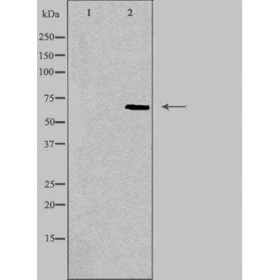 DF3295 staining Hela cells by IF/ICC. The sample were fixed with PFA and permeabilized in 0.1% Triton X-100,then blocked in 10% serum for 45 minutes at 25¡ãC. The primary antibody was diluted at 1/200 and incubated with the sample for 1 hour at 37¡ãC. An  Alexa Fluor 594 conjugated goat anti-rabbit IgG (H+L) antibody(Cat.# S0006), diluted at 1/600, was used as secondary antibod