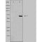 DF3295 staining Hela cells by IF/ICC. The sample were fixed with PFA and permeabilized in 0.1% Triton X-100,then blocked in 10% serum for 45 minutes at 25¡ãC. The primary antibody was diluted at 1/200 and incubated with the sample for 1 hour at 37¡ãC. An  Alexa Fluor 594 conjugated goat anti-rabbit IgG (H+L) antibody(Cat.# S0006), diluted at 1/600, was used as secondary antibod