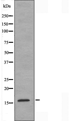 DF3297 staining HepG2 by IF/ICC. The sample were fixed with PFA and permeabilized in 0.1% Triton X-100,then blocked in 10% serum for 45 minutes at 25¡ãC. The primary antibody was diluted at 1/200 and incubated with the sample for 1 hour at 37¡ãC. An  Alexa Fluor 594 conjugated goat anti-rabbit IgG (H+L) Ab, diluted at 1/600, was used as the secondary antibod