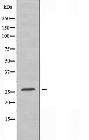 DF3299 staining HuvEc cells by IF/ICC. The sample were fixed with PFA and permeabilized in 0.1% Triton X-100,then blocked in 10% serum for 45 minutes at 25¡ãC. The primary antibody was diluted at 1/200 and incubated with the sample for 1 hour at 37¡ãC. An  Alexa Fluor 594 conjugated goat anti-rabbit IgG (H+L) antibody(Cat.
