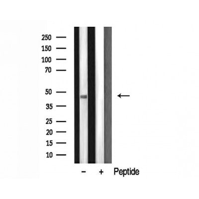 DF3301 at 1/100 staining Human breast cancer tissue by IHC-P. The sample was formaldehyde fixed and a heat mediated antigen retrieval step in citrate buffer was performed. The sample was then blocked and incubated with the antibody for 1.5 hours at 22¡ãC. An HRP conjugated goat anti-rabbit antibody was used as the secondary