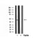 DF3301 at 1/100 staining Human breast cancer tissue by IHC-P. The sample was formaldehyde fixed and a heat mediated antigen retrieval step in citrate buffer was performed. The sample was then blocked and incubated with the antibody for 1.5 hours at 22¡ãC. An HRP conjugated goat anti-rabbit antibody was used as the secondary
