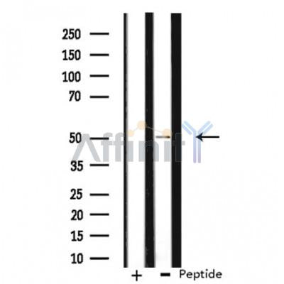 DF3303 staining 293 cells by IF/ICC. The sample were fixed with PFA and permeabilized in 0.1% Triton X-100,then blocked in 10% serum for 45 minutes at 25¡ãC. The primary antibody was diluted at 1/200 and incubated with the sample for 1 hour at 37¡ãC. An  Alexa Fluor 594 conjugated goat anti-rabbit IgG (H+L) antibody(Cat.# S0006), diluted at 1/600, was used as secondary antibod
