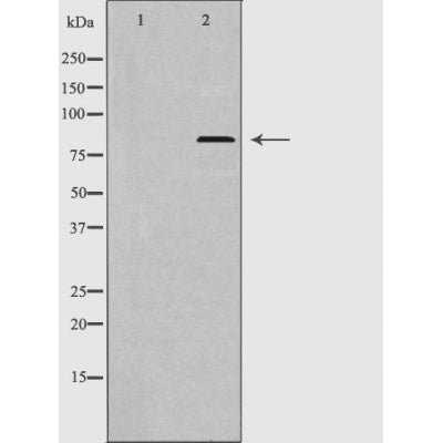 DF3304 staining HepG2 by IF/ICC. The sample were fixed with PFA and permeabilized in 0.1% Triton X-100,then blocked in 10% serum for 45 minutes at 25¡ãC. The primary antibody was diluted at 1/200 and incubated with the sample for 1 hour at 37¡ãC. An  Alexa Fluor 594 conjugated goat anti-rabbit IgG (H+L) Ab, diluted at 1/600, was used as the secondary antibod