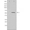 DF3305 staining  Hela cells by IF/ICC. The sample were fixed with PFA and permeabilized in 0.1% Triton X-100,then blocked in 10% serum for 45 minutes at 25¡ãC. The primary antibody was diluted at 1/200 and incubated with the sample for 1 hour at 37¡ãC. An  Alexa Fluor 594 conjugated goat anti-rabbit IgG (H+L) antibody(Cat.# S0006), diluted at 1/600, was used as secondary antibod