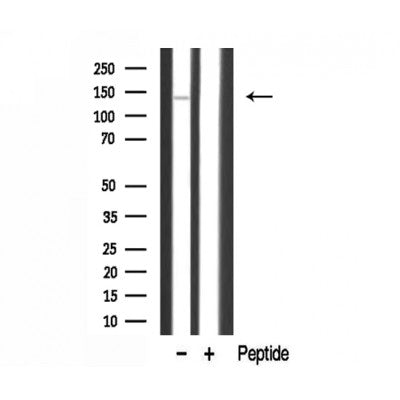 DF3306 staining  HuvEc cells by IF/ICC. The sample were fixed with PFA and permeabilized in 0.1% Triton X-100,then blocked in 10% serum for 45 minutes at 25¡ãC. The primary antibody was diluted at 1/200 and incubated with the sample for 1 hour at 37¡ãC. An  Alexa Fluor 594 conjugated goat anti-rabbit IgG (H+L) antibody(Cat.