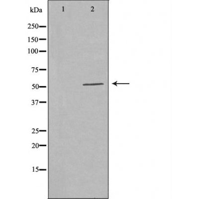 DF3307 staining HeLa cells by IF/ICC. The sample were fixed with PFA and permeabilized in 0.1% Triton X-100,then blocked in 10% serum for 45 minutes at 25¡ãC. The primary antibody was diluted at 1/200 and incubated with the sample for 1 hour at 37¡ãC. An  Alexa Fluor 594 conjugated goat anti-rabbit IgG (H+L) antibody(Cat.# S0006), diluted at 1/600, was used as secondary antibod