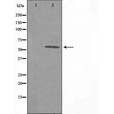 DF3310 staining  Hela cells by IF/ICC. The sample were fixed with PFA and permeabilized in 0.1% Triton X-100,then blocked in 10% serum for 45 minutes at 25¡ãC. The primary antibody was diluted at 1/200 and incubated with the sample for 1 hour at 37¡ãC. An  Alexa Fluor 594 conjugated goat anti-rabbit IgG (H+L) antibody(Cat.# S0006), diluted at 1/600, was used as secondary antibod