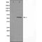 DF3310 staining  Hela cells by IF/ICC. The sample were fixed with PFA and permeabilized in 0.1% Triton X-100,then blocked in 10% serum for 45 minutes at 25¡ãC. The primary antibody was diluted at 1/200 and incubated with the sample for 1 hour at 37¡ãC. An  Alexa Fluor 594 conjugated goat anti-rabbit IgG (H+L) antibody(Cat.# S0006), diluted at 1/600, was used as secondary antibod