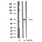 DF3314 staining Hela by IF/ICC. The sample were fixed with PFA and permeabilized in 0.1% Triton X-100,then blocked in 10% serum for 45 minutes at 25¡ãC. The primary antibody was diluted at 1/200 and incubated with the sample for 1 hour at 37¡ãC. An  Alexa Fluor 594 conjugated goat anti-rabbit IgG (H+L) Ab, diluted at 1/600, was used as the secondary antibod