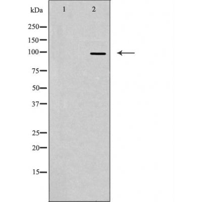 DF3315 staining Hela by IF/ICC. The sample were fixed with PFA and permeabilized in 0.1% Triton X-100,then blocked in 10% serum for 45 minutes at 25¡ãC. The primary antibody was diluted at 1/200 and incubated with the sample for 1 hour at 37¡ãC. An  Alexa Fluor 594 conjugated goat anti-rabbit IgG (H+L) Ab, diluted at 1/600, was used as the secondary antibod