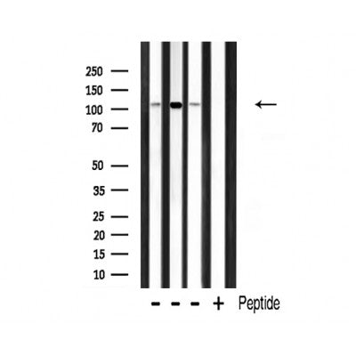 DF3319 staining Hela by IF/ICC. The sample were fixed with PFA and permeabilized in 0.1% Triton X-100,then blocked in 10% serum for 45 minutes at 25¡ãC. The primary antibody was diluted at 1/200 and incubated with the sample for 1 hour at 37¡ãC. An  Alexa Fluor 594 conjugated goat anti-rabbit IgG (H+L) Ab, diluted at 1/600, was used as the secondary antibod