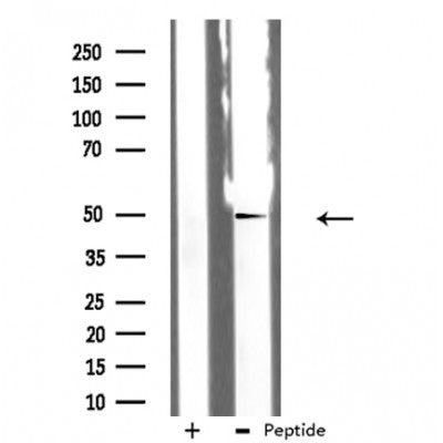 DF3320 staining RAW264.7 by IF/ICC. The sample were fixed with PFA and permeabilized in 0.1% Triton X-100,then blocked in 10% serum for 45 minutes at 25¡ãC. The primary antibody was diluted at 1/200 and incubated with the sample for 1 hour at 37¡ãC. An  Alexa Fluor 594 conjugated goat anti-rabbit IgG (H+L) Ab, diluted at 1/600, was used as the secondary antibod