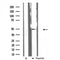 DF3320 staining RAW264.7 by IF/ICC. The sample were fixed with PFA and permeabilized in 0.1% Triton X-100,then blocked in 10% serum for 45 minutes at 25¡ãC. The primary antibody was diluted at 1/200 and incubated with the sample for 1 hour at 37¡ãC. An  Alexa Fluor 594 conjugated goat anti-rabbit IgG (H+L) Ab, diluted at 1/600, was used as the secondary antibod