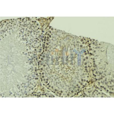 DF3322 staining Hela by IF/ICC. The sample were fixed with PFA and permeabilized in 0.1% Triton X-100,then blocked in 10% serum for 45 minutes at 25¡ãC. The primary antibody was diluted at 1/200 and incubated with the sample for 1 hour at 37¡ãC. An  Alexa Fluor 594 conjugated goat anti-rabbit IgG (H+L) Ab, diluted at 1/600, was used as the secondary antibod