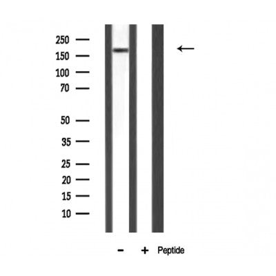 DF3324 staining Hela cells by IF/ICC. The sample were fixed with PFA and permeabilized in 0.1% Triton X-100,then blocked in 10% serum for 45 minutes at 25¡ãC. The primary antibody was diluted at 1/200 and incubated with the sample for 1 hour at 37¡ãC. An  Alexa Fluor 594 conjugated goat anti-rabbit IgG (H+L) antibody(Cat.