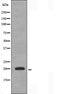 DF3326 staining HuvEc by IF/ICC. The sample were fixed with PFA and permeabilized in 0.1% Triton X-100,then blocked in 10% serum for 45 minutes at 25¡ãC. The primary antibody was diluted at 1/200 and incubated with the sample for 1 hour at 37¡ãC. An  Alexa Fluor 594 conjugated goat anti-rabbit IgG (H+L) Ab, diluted at 1/600, was used as the secondary antibod
