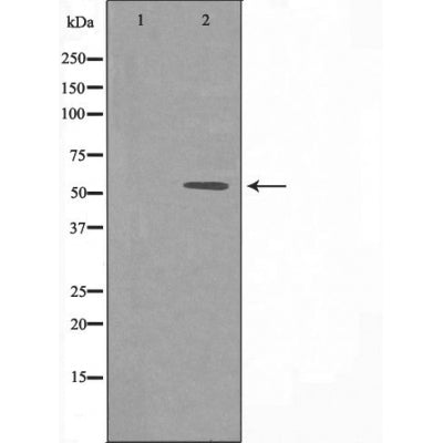 DF3331 staining HepG2 by IF/ICC. The sample were fixed with PFA and permeabilized in 0.1% Triton X-100,then blocked in 10% serum for 45 minutes at 25¡ãC. The primary antibody was diluted at 1/200 and incubated with the sample for 1 hour at 37¡ãC. An  Alexa Fluor 594 conjugated goat anti-rabbit IgG (H+L) Ab, diluted at 1/600, was used as the secondary antibod