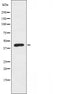 DF3332 staining COLO205 cells by IF/ICC. The sample were fixed with PFA and permeabilized in 0.1% Triton X-100,then blocked in 10% serum for 45 minutes at 25¡ãC. The primary antibody was diluted at 1/200 and incubated with the sample for 1 hour at 37¡ãC. An  Alexa Fluor 594 conjugated goat anti-rabbit IgG (H+L) antibody(Cat.# S0006), diluted at 1/600, was used as secondary antibod