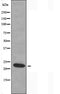 DF3337 staining COLO205 by IF/ICC. The sample were fixed with PFA and permeabilized in 0.1% Triton X-100,then blocked in 10% serum for 45 minutes at 25¡ãC. The primary antibody was diluted at 1/200 and incubated with the sample for 1 hour at 37¡ãC. An  Alexa Fluor 594 conjugated goat anti-rabbit IgG (H+L) Ab, diluted at 1/600, was used as the secondary antibod