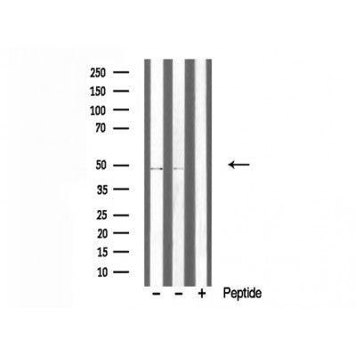 DF3343 at 1/100 staining Mouse muscle tissue by IHC-P. The sample was formaldehyde fixed and a heat mediated antigen retrieval step in citrate buffer was performed. The sample was then blocked and incubated with the antibody for 1.5 hours at 22¡ãC. An HRP conjugated goat anti-rabbit antibody was used as the secondary