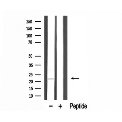 DF3345 staining LOVO by IF/ICC. The sample were fixed with PFA and permeabilized in 0.1% Triton X-100,then blocked in 10% serum for 45 minutes at 25¡ãC. The primary antibody was diluted at 1/200 and incubated with the sample for 1 hour at 37¡ãC. An  Alexa Fluor 594 conjugated goat anti-rabbit IgG (H+L) Ab, diluted at 1/600, was used as the secondary antibod