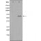 DF3346 staining  HeLa cells by IF/ICC. The sample were fixed with PFA and permeabilized in 0.1% Triton X-100,then blocked in 10% serum for 45 minutes at 25¡ãC. The primary antibody was diluted at 1/200 and incubated with the sample for 1 hour at 37¡ãC. An  Alexa Fluor 594 conjugated goat anti-rabbit IgG (H+L) antibody(Cat.