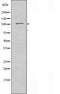 DF3347 staining Hela cells by IF/ICC. The sample were fixed with PFA and permeabilized in 0.1% Triton X-100,then blocked in 10% serum for 45 minutes at 25¡ãC. The primary antibody was diluted at 1/200 and incubated with the sample for 1 hour at 37¡ãC. An  Alexa Fluor 594 conjugated goat anti-rabbit IgG (H+L) antibody(Cat.# S0006), diluted at 1/600, was used as secondary antibod