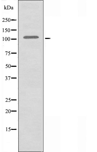 DF3348 staining Hela by IF/ICC. The sample were fixed with PFA and permeabilized in 0.1% Triton X-100,then blocked in 10% serum for 45 minutes at 25¡ãC. The primary antibody was diluted at 1/200 and incubated with the sample for 1 hour at 37¡ãC. An  Alexa Fluor 594 conjugated goat anti-rabbit IgG (H+L) Ab, diluted at 1/600, was used as the secondary antibod