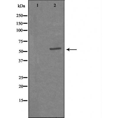 DF3351 at 1/100 staining Mouse intestine tissue by IHC-P. The sample was formaldehyde fixed and a heat mediated antigen retrieval step in citrate buffer was performed. The sample was then blocked and incubated with the antibody for 1.5 hours at 22¡ãC. An HRP conjugated goat anti-rabbit antibody was used as the secondary