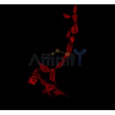 Western blot analysis of extracts from various samples, using PPP1R14C Antibody. Lane 1: 293  treated with  blocking peptide; Lane 2: 293; Lane 3: mouse brain; 