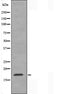 DF3362 staining Hela by IF/ICC. The sample were fixed with PFA and permeabilized in 0.1% Triton X-100,then blocked in 10% serum for 45 minutes at 25¡ãC. The primary antibody was diluted at 1/200 and incubated with the sample for 1 hour at 37¡ãC. An  Alexa Fluor 594 conjugated goat anti-rabbit IgG (H+L) Ab, diluted at 1/600, was used as the secondary antibod
