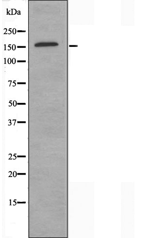 DF3363 staining HuvEc cells by IF/ICC. The sample were fixed with PFA and permeabilized in 0.1% Triton X-100,then blocked in 10% serum for 45 minutes at 25¡ãC. The primary antibody was diluted at 1/200 and incubated with the sample for 1 hour at 37¡ãC. An  Alexa Fluor 594 conjugated goat anti-rabbit IgG (H+L) antibody(Cat.# S0006), diluted at 1/600, was used as secondary antibod