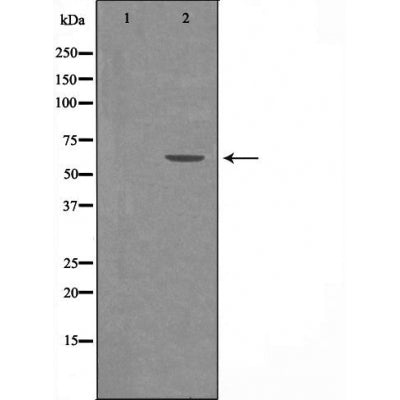 DF3422 staining 293 by IF/ICC. The sample were fixed with PFA and permeabilized in 0.1% Triton X-100,then blocked in 10% serum for 45 minutes at 25¡ãC. The primary antibody was diluted at 1/200 and incubated with the sample for 1 hour at 37¡ãC. An  Alexa Fluor 594 conjugated goat anti-rabbit IgG (H+L) Ab, diluted at 1/600, was used as the secondary antibod