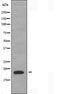 DF3426 staining Hela cells by IF/ICC. The sample were fixed with PFA and permeabilized in 0.1% Triton X-100,then blocked in 10% serum for 45 minutes at 25¡ãC. The primary antibody was diluted at 1/200 and incubated with the sample for 1 hour at 37¡ãC. An  Alexa Fluor 594 conjugated goat anti-rabbit IgG (H+L) antibody(Cat.