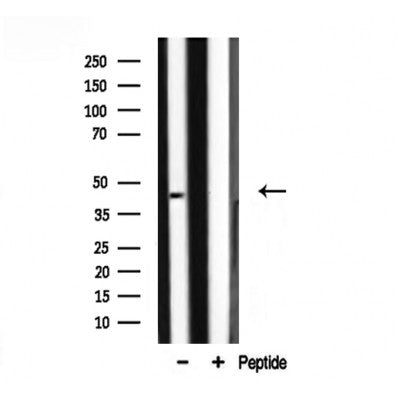 DF3427 at 1/100 staining Human liver tissue by IHC-P. The sample was formaldehyde fixed and a heat mediated antigen retrieval step in citrate buffer was performed. The sample was then blocked and incubated with the antibody for 1.5 hours at 22¡ãC. An HRP conjugated goat anti-rabbit antibody was used as the secondary