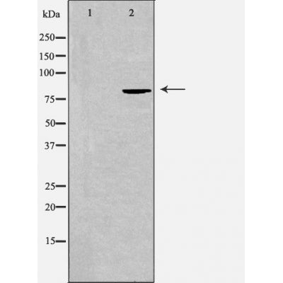 DF3434 at 1/100 staining Mouse intestine tissue by IHC-P. The sample was formaldehyde fixed and a heat mediated antigen retrieval step in citrate buffer was performed. The sample was then blocked and incubated with the antibody for 1.5 hours at 22¡ãC. An HRP conjugated goat anti-rabbit antibody was used as the secondary